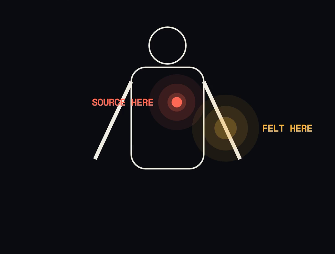 A body outline with the source of pain in the chest and the felt pain in the left arm.