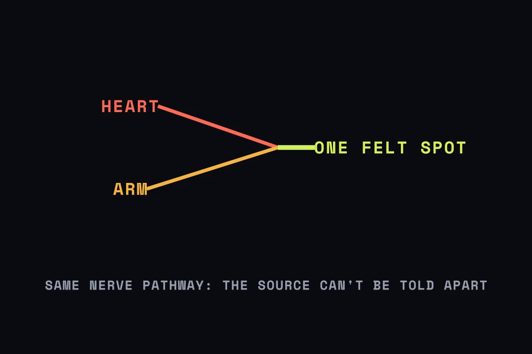 Signals from the heart and the arm converge on one pathway and produce one felt spot.